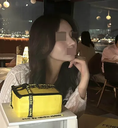 Review nâng mũi lại bằng sụn sườn tự thân tại Want