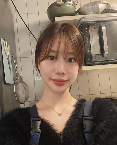 Chỉnh sửa mũi vẹo, phẫu thuật lại! Mình rất hài lòng.