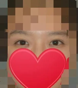 Để mọi người dễ hình dung nên mình đính kèm ảnh ạ