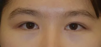 Cuối cùng mình cũng làm mắt to không cắt mí rồiiiiii ㅋㅋㅋㅋㅋ