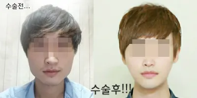 Xin chào. Lâu lắm rồi mới đến bệnh viện xem kết quả