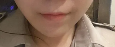 Bác sĩ ơi khỏe không ạ? Mình là Eun-jeong, người làm phẫu thuật gọt hàm đây ạ.