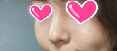 Các chị tư vấn, y tá, bác sĩ ở Apex dạo này khỏe không ạ?