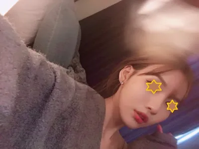 Đã 6 tháng kể từ khi mình làm Harmony mũi ở Apex ạ.