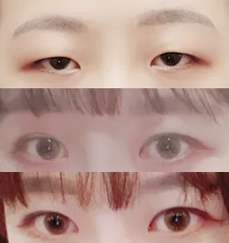 Review sau khi chỉnh sửa mắt và mở góc mắt trước