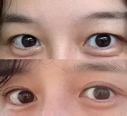 Review Nâng Cung Mày