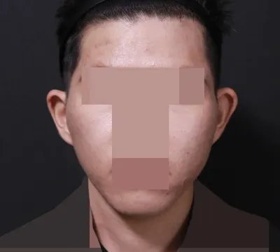 Mình thấy khuôn mặt đang thay đổi.