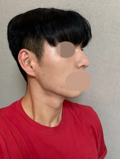 Vì trông tự nhiên nên ai cũng hỏi mình.