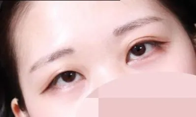 Mình rất hài lòng vì có được đường nét tự nhiên và rõ ràng!