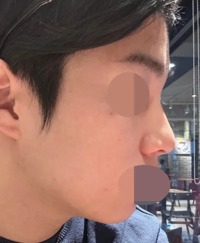 Hiện tại đã được khoảng 3 tháng rồi và mình đang rất hài lòng với dáng.