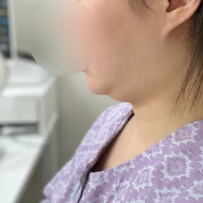 Với đường xương hàm sắc lẹm, mình thấy rất rất tuyệt vời.