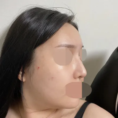 Đường nét vẫn giữ nguyên y hệt như lúc mình mới tháo nẹp, xịn lắm luôn.