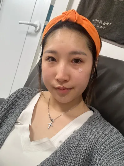 Sẵn tiện đã quyết tâm nên mình làm cả mắt và mũi cùng lúc, mình thấy rất rất hài lòng.