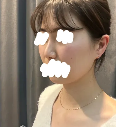 Mình rất ưng ý. Thẩm mỹ viện Very Good là tuyệt nhất, tuyệt nhất.