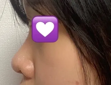 Dạo này mình đang trải qua những ngày hạnh phúc vì mọi người khen mình đã trở nên rất xinh đẹp.