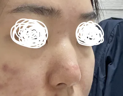 Kết quả là mình cực kỳ hài lòng, họ đã sao chép và dán y hệt bức ảnh mình mang theo luôn ㅠㅜ