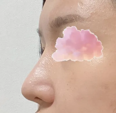 Từ trước đến nay, đây là lần đầu tiên mình thấy một bệnh viện quan tâm chu đáo đến vậy khi làm phẫu thuật thẩm mỹ.