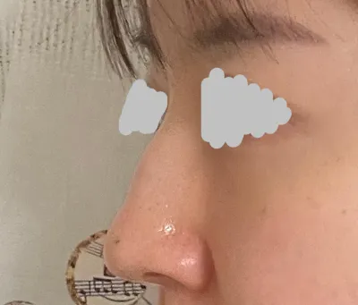 Mình rất hài lòng vì được giải thích rất tận tình và ca phẫu thuật cũng diễn ra rất tốt!