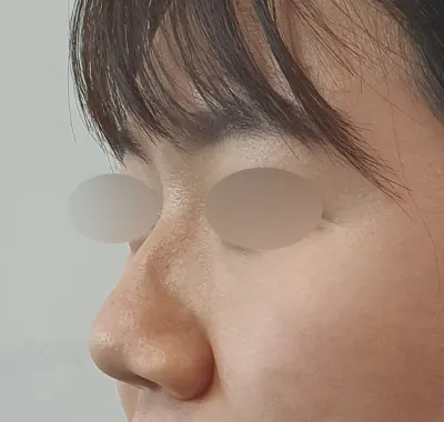 Viện trưởng Kim Yong-woo, Viện trưởng Nam Jae-seong, những người cha thứ hai của mình!!! Cảm ơn các viện trưởng đã phẫu thuật cho mình thật đẹp!♥♥