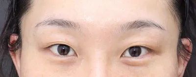 Nếu mình định làm thêm ở chỗ khác, mình nghĩ mình sẽ ghé Thẩm mỹ viện Very Good đầu tiên. Cực kỳ đề xuất!!