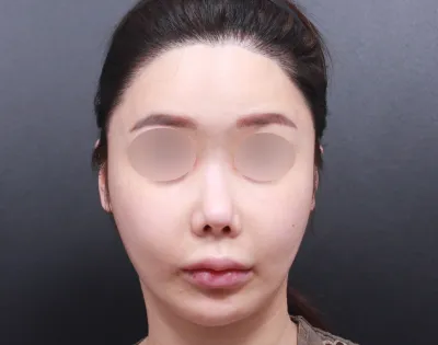 Mình chỉ phẫu thuật ở đây thôi.. Các bác sĩ rất có trách nhiệm và nhân viên thực sự thân thiện.