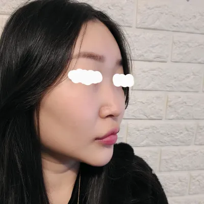 Cảm ơn Viện trưởng Lim Young-min đã làm cho mình chiếc mũi đẹp và Viện trưởng Nam Jae-seong đã chữa khỏi bệnh viêm mũi cho mình~