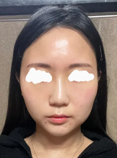 Đừng chần chừ mà hãy làm ngay đi mọi người ơi!!!