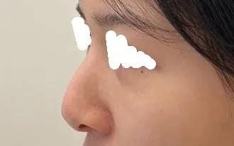 Sao mình không làm sớm hơn nhỉ ㅠㅠ Lẽ ra mình nên xinh đẹp sớm hơn ㅜㅜ