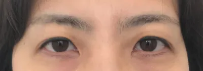 Mọi người cứ hỏi mình suốt là bệnh viện nào và bác sĩ nào vì bảo là hình ảnh của mình đã thay đổi rồi ㅎㅎ