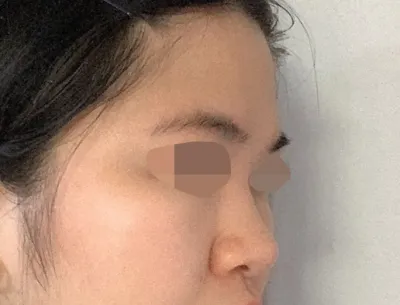 Mình thực sự hiểu tại sao lại có từ 'thánh bác sĩ' rồi. Cực kỳ hài lòng!!