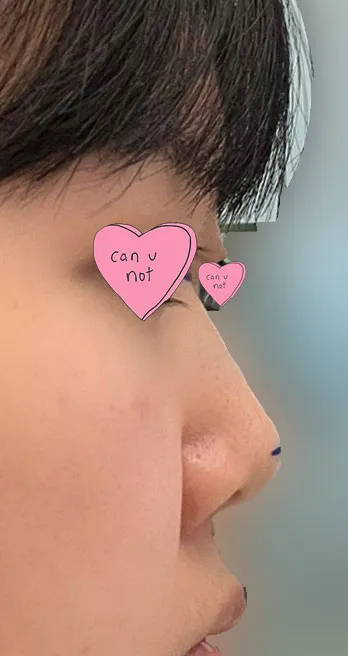 Mình cảm thấy thật đúng đắn khi tin tưởng Viện trưởng Lim Young-min để phẫu thuật, mình cực kỳ giới thiệu luôn!