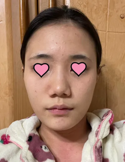 Thật sự cảm ơn vì đã khắc phục mọi khuyết điểm của mình và tạo ra một chiếc mũi hoàn hảo!