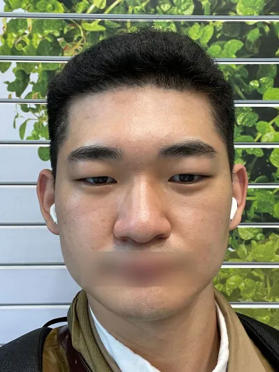 Trong suốt cuộc đời cho đến nay, điều mà mình cảm thấy mình đã lựa chọn đúng đắn chính là phẫu thuật thẩm mỹ.