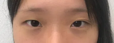 Được làm đẹp quá nên mình đang sống rất hài lòng!!