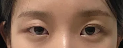 Chất lượng cuộc sống của mình đã thay đổi đôi chút kể từ khi không còn dán miếng kích mí nữa.. Mình thấy rất hài lòng >_<