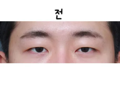 Đã hơn 5 tháng kể từ khi mình phẫu thuật với bác sĩ Park Sang-wook.