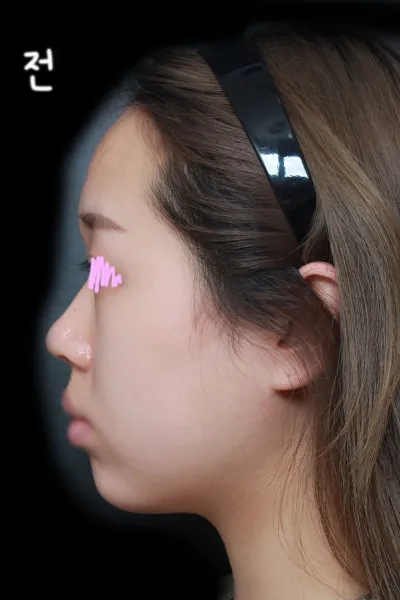 Mọi người đều hỏi mình bệnh viện ở đâu ㅎㅎ Cảm ơn ạ ❤