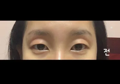 Mọi người nhất định phải mở góc mắt trong nhé ㅜㅜ