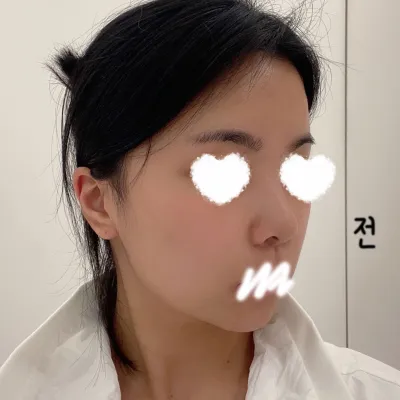 Mình làm ở Bệnh viện thẩm mỹ Very Good và đã được 5 tháng rồi hihi.