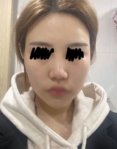 Review gọt mặt tháng thứ 3 của mình.