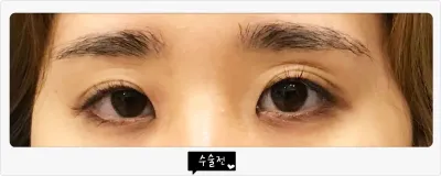 Đây là bài review của mình về thẩm mỹ viện Very Good.