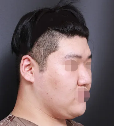 Quả nhiên Viện trưởng Lim Young-min là tuyệt nhất.