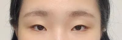 Cuối cùng thì mình cũng đã làm mắt hai mí mà mình hằng mong đợi rồi..