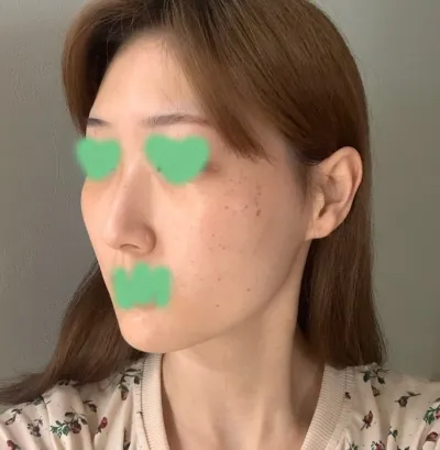 Mình rất vui vì nỗi mặc cảm đeo bám mình suốt mấy năm qua đã biến mất chỉ sau vài ngày. Mình thực sự nhiệt tình đề xuất luôn!!