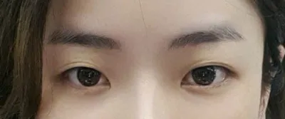 Rõ nét và tự nhiên đến mức mình tự hỏi tại sao mình lại từng nghĩ đến việc cắt mí luôn!