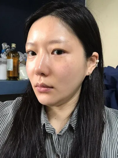 Dù mình đã ngoài 30 nhưng hiệu quả nâng cơ có vẻ rất rõ rệt trong việc giúp mình được khen là trẻ trung hihi.