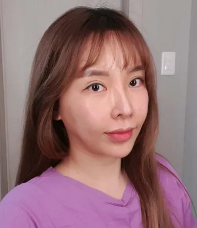 Mình đã hút mỡ ngực và nọng cằm, cấy mỡ toàn mặt và nâng cơ.