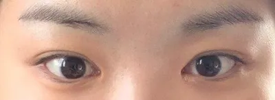 Vì Very Good là địa chỉ cắt mí cực đỉnh nên những bạn nào còn đang phân vân thì hãy mau ghé qua nhé!