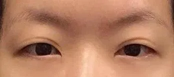 Xin chào. Đã 6 tháng trôi qua kể từ khi mình phẫu thuật rồi.