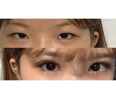 Mình rất hài lòng về ca phẫu thuật.